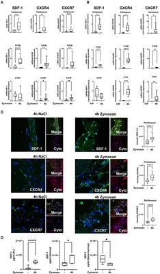 Inhibition of CXCR4 and CXCR7 Is Protective in Acute Peritoneal Inflammation